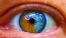 heterochromia iridum - TheFarmersInTheDell.com